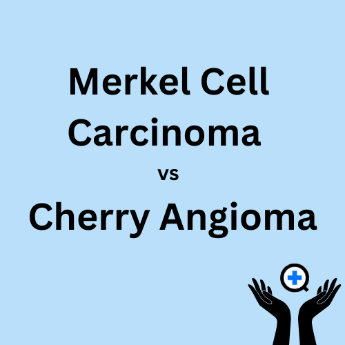 A blue image with text saying "Merkel cell carcinoma vs cherry angioma"