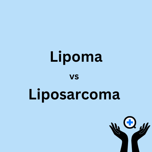 A blue image with text saying "Lipoma vs Liposarcoma"