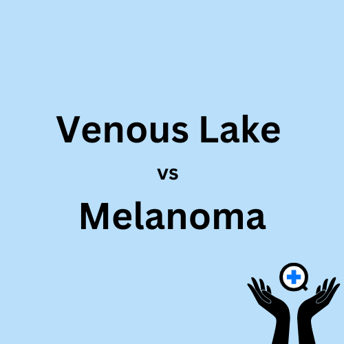 A blue image with text saying "Venous Lake vs Melanoma"