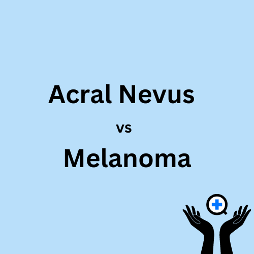 A blue image with text saying "Acral Nevus vs Melanoma: Understanding the Differences"